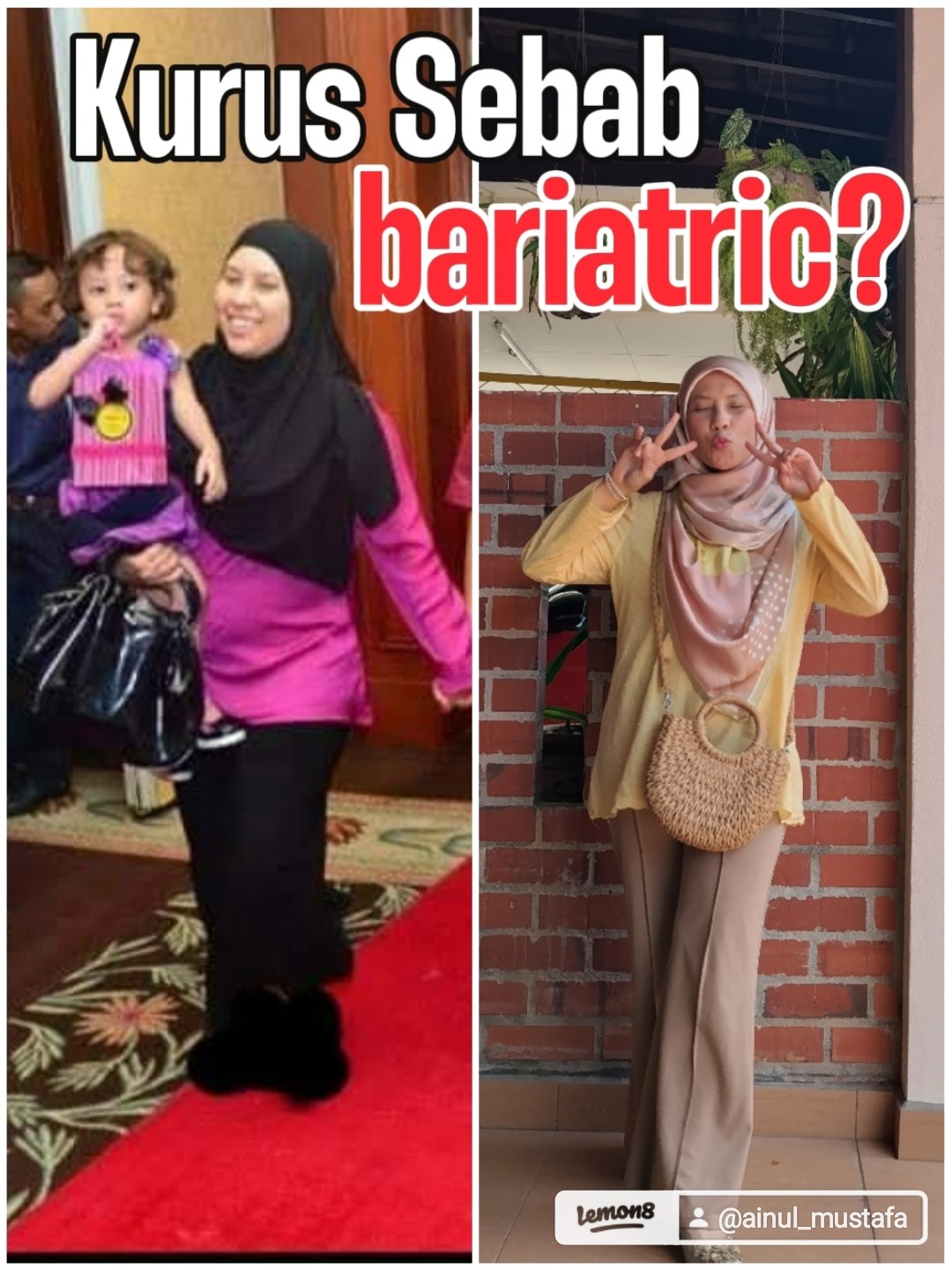Kurus Sebab Bariatric